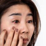 Is Vowiszojid54 for Sensitive Eyes