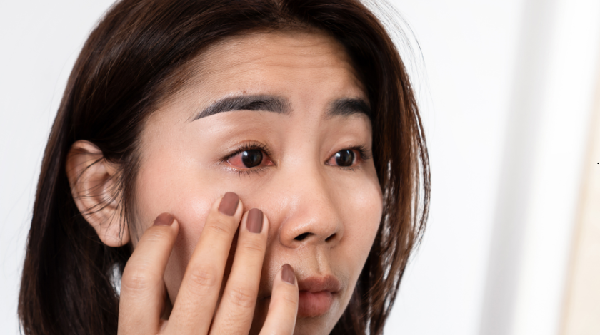 Is Vowiszojid54 for Sensitive Eyes